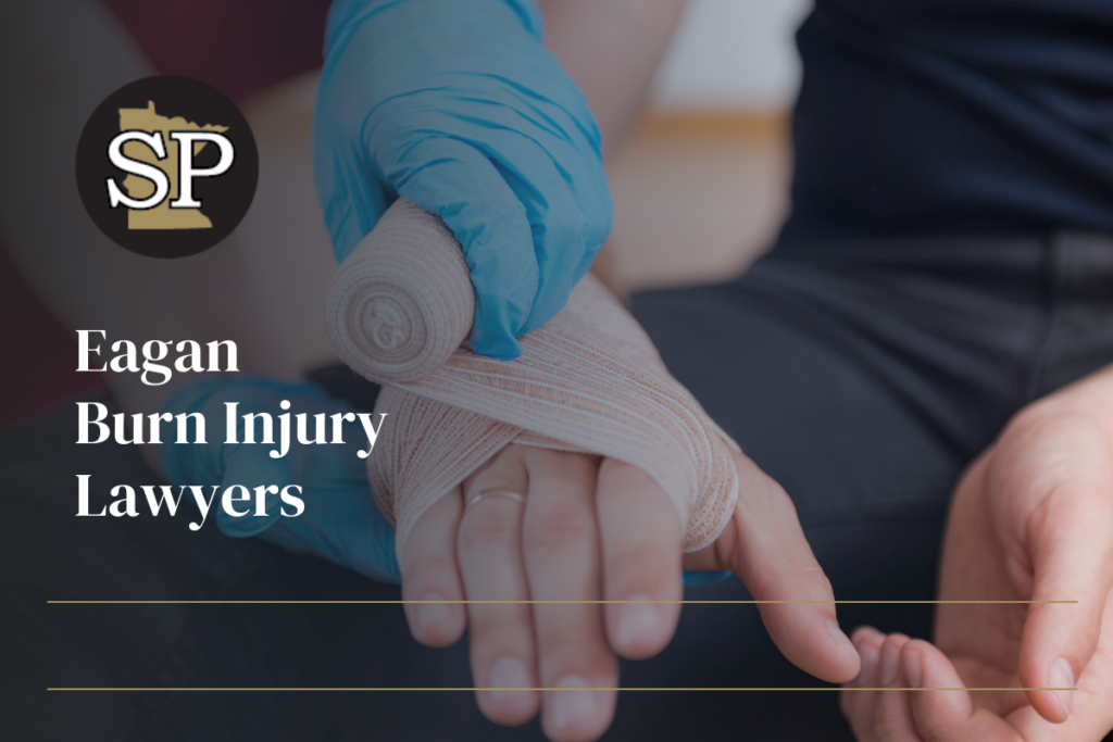 Eagan Burn Injury Lawyers